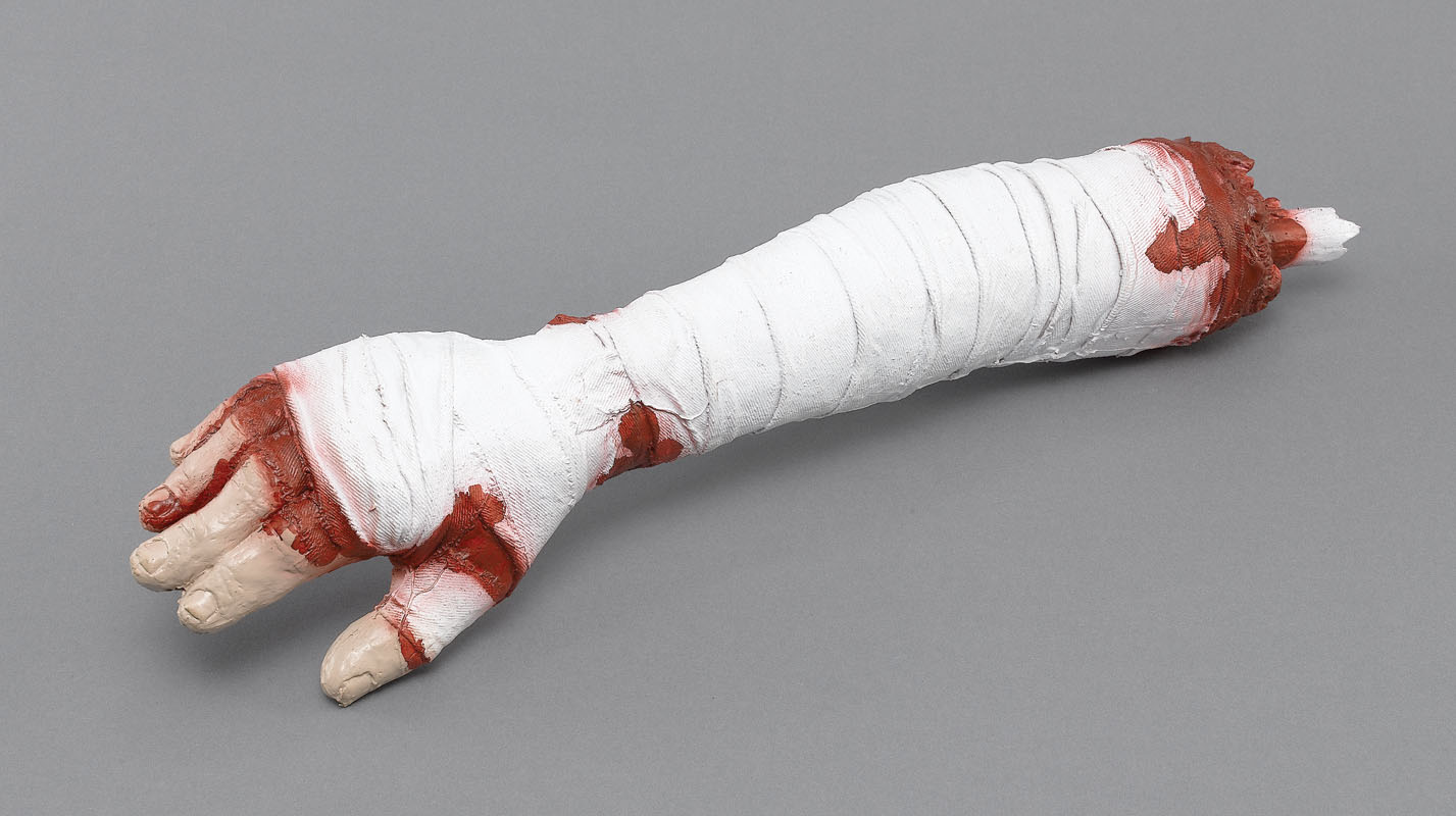Broken Mummy Arm